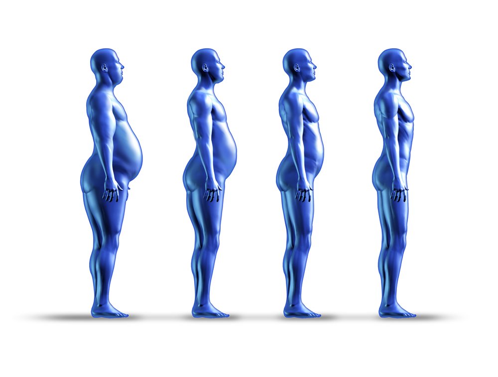 cirurgia bariatrica diabetes