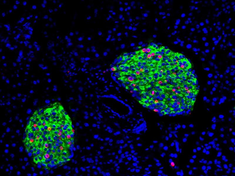 Imagem da pesquisa do dr. Melton mostra células-beta (em verde) no pâncreas se replicando (as novas células aparecem em vermelho), induzidas pela betatrofina. Crédito: Peng Yi.