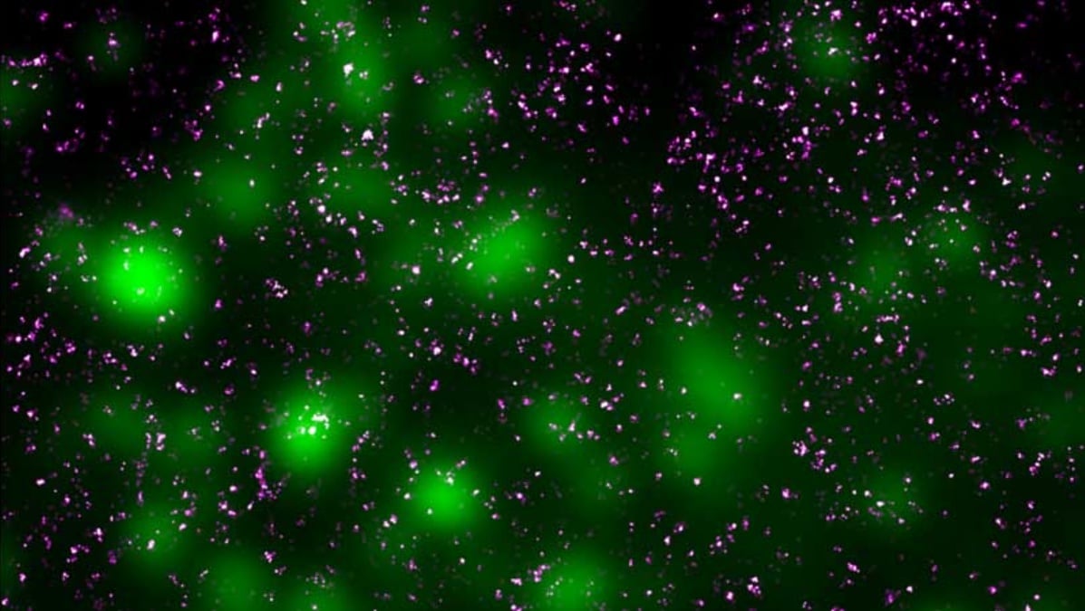 Técnicas modernas de microscopia permitem visualizar em detalhes o conteúdo de células humanas. Neste exemplo, as proteínas SNARE são marcadas em roxo, e as vesículas que as liberam estão em verde.
