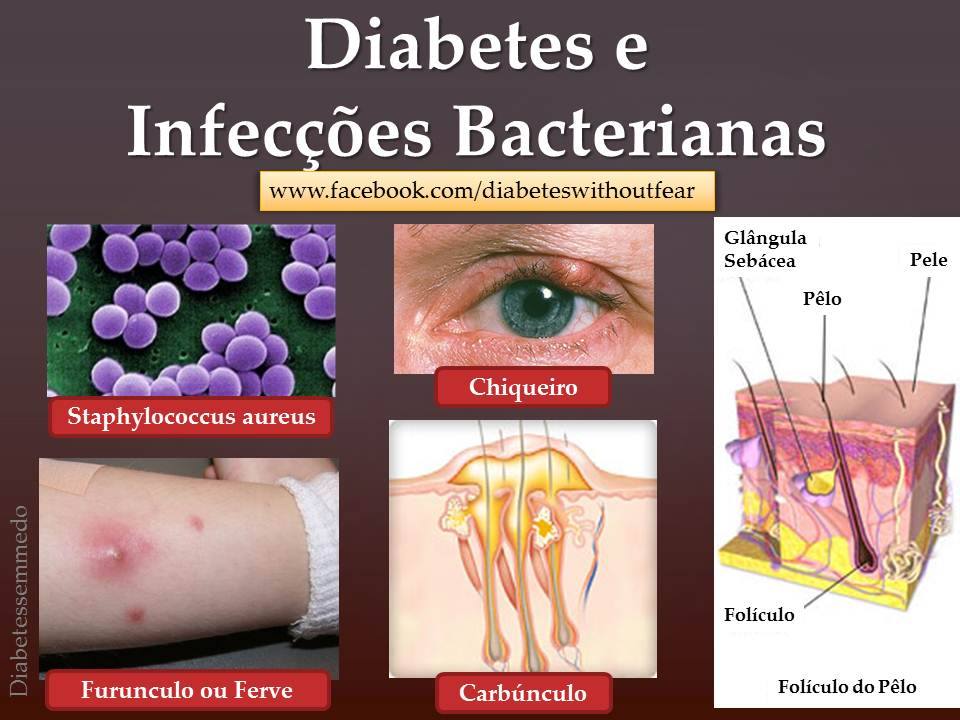 diabetes e infeccoes bacterianas