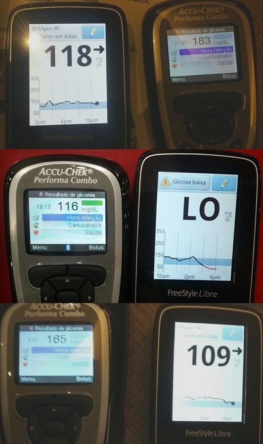 freestyle libre - variações de medição de glicemia